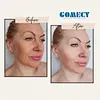 hifu face machine